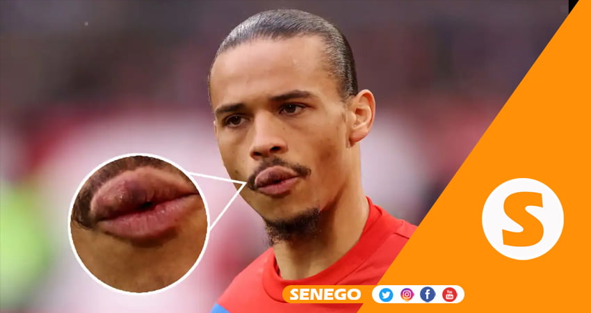 Sadio Mané n’a pas manqué Leroy Sané : lèvre sérieusement éclatée (Photos)