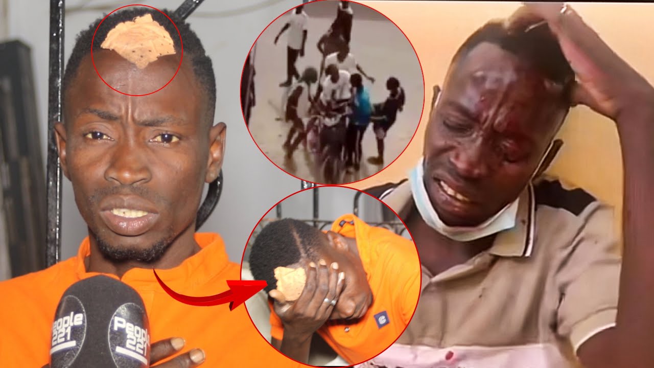 Mbaye Kouthia aprés son accident: » Birane Ndour moma dieul en charge lepp » (vidéo)
