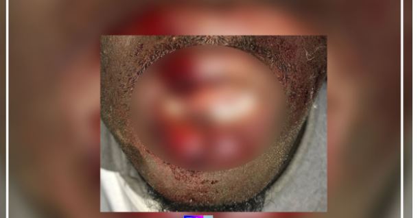 Thiadiaye: Une plainte annoncée après l’attaque de la  caravane de Pastef