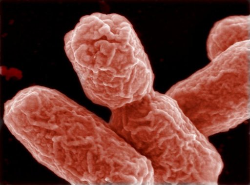 Résistance des souches d’Escherichia coli aux antibiotiques au Sénégal : nouvelles découvertes