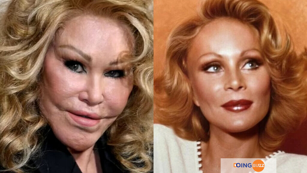 Jocelyn Wildenstein dévoile son vrai visage avant ses nombreuses chirurgies esthétiques...