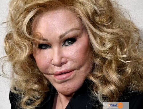 Jocelyn Wildenstein dévoile son vrai visage avant ses nombreuses chirurgies esthétiques...