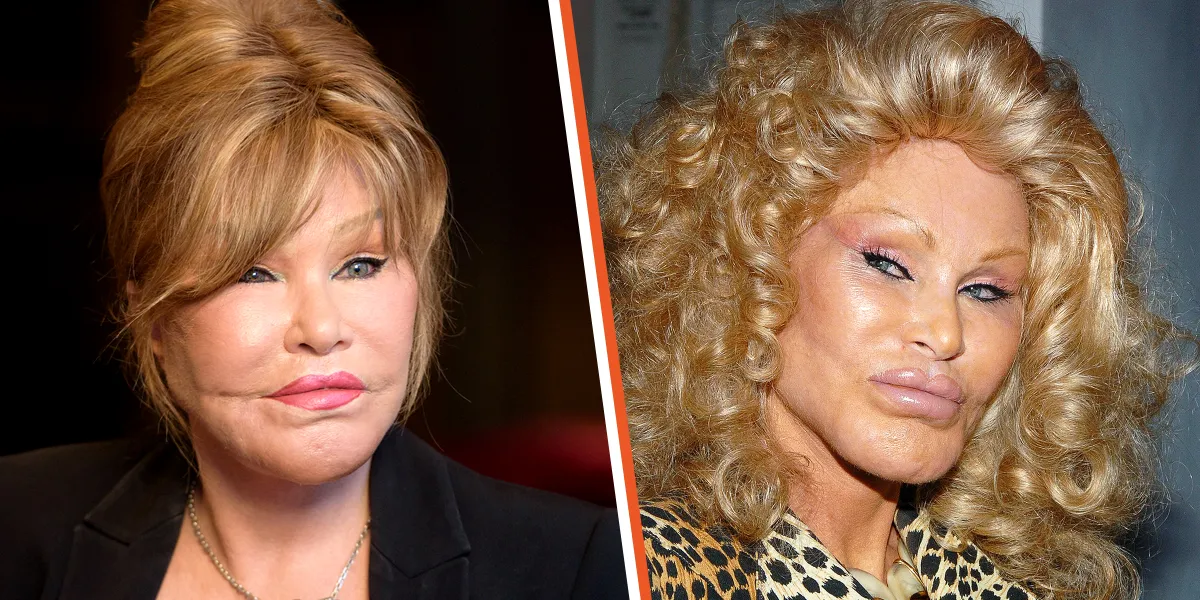 Jocelyn Wildenstein dévoile son vrai visage avant ses nombreuses chirurgies esthétiques…