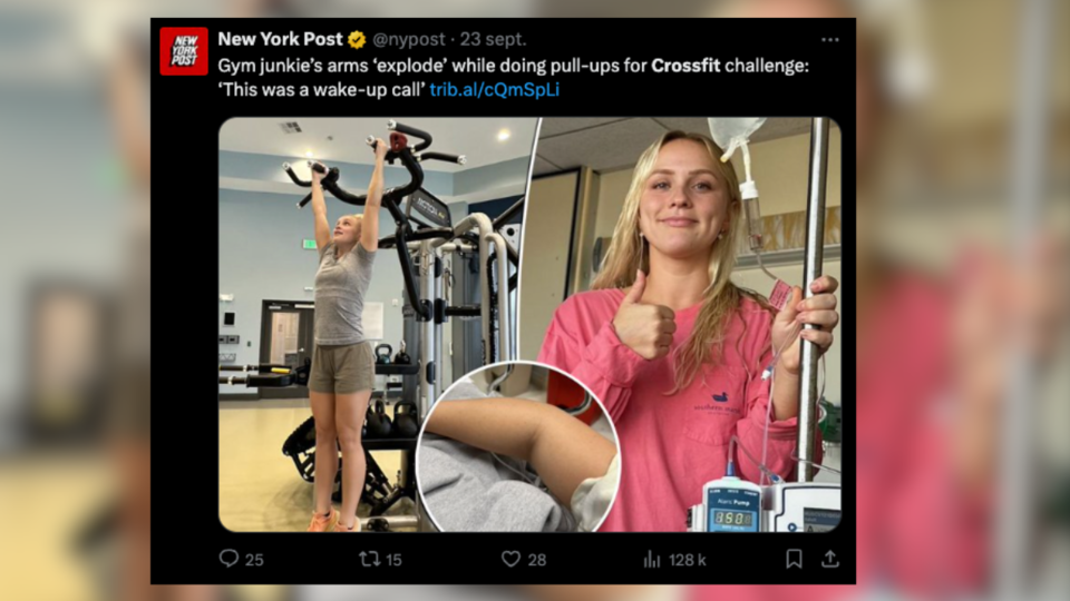 États-Unis : une adepte du crossfit gravement blessée après un challenge extrême