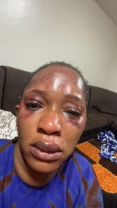 Djelykaba Bintou dénonce des violences conjugales et accuse son ex-mari