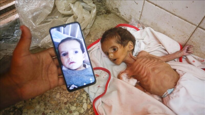 Gaza : 66 enfants morts de malnutrition depuis octobre, selon les autorités locales