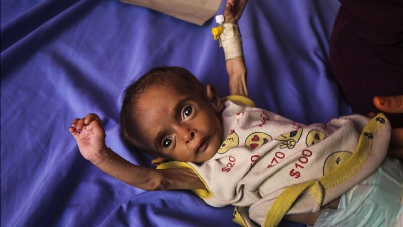 Gaza : Deux nouveaux décès dus à la famine, le blocus israélien aggrave la crise humanitaire
