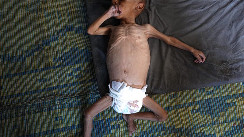 Gaza : Sept nouveaux décès dus à la famine, le bilan s'alourdit à 169 morts