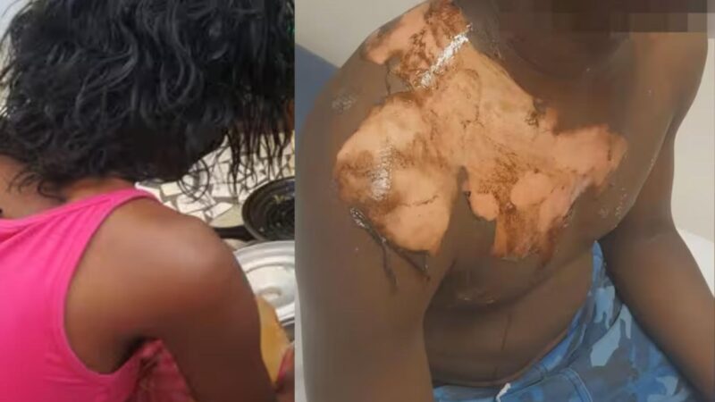 Touba : une femme ébouillante son mari qui voulait prendre une seconde épouse — « J’ai agi sous l’influence de Satan »