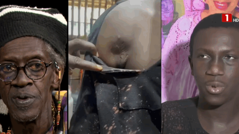 Victime d’une balle en pleine épaule, le fils de Cheikh Lo raconte sa mésaventure lors des événements de 2021 à 2024…