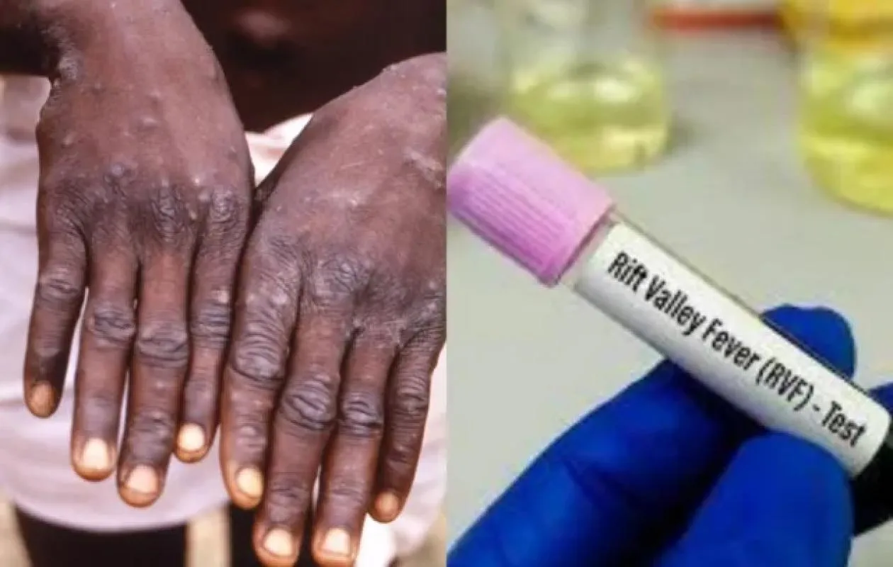 Fièvre de la Vallée du Rift au Sénégal : Le bilan s’alourdit et passe à 443 cas confirmés et 31 décès