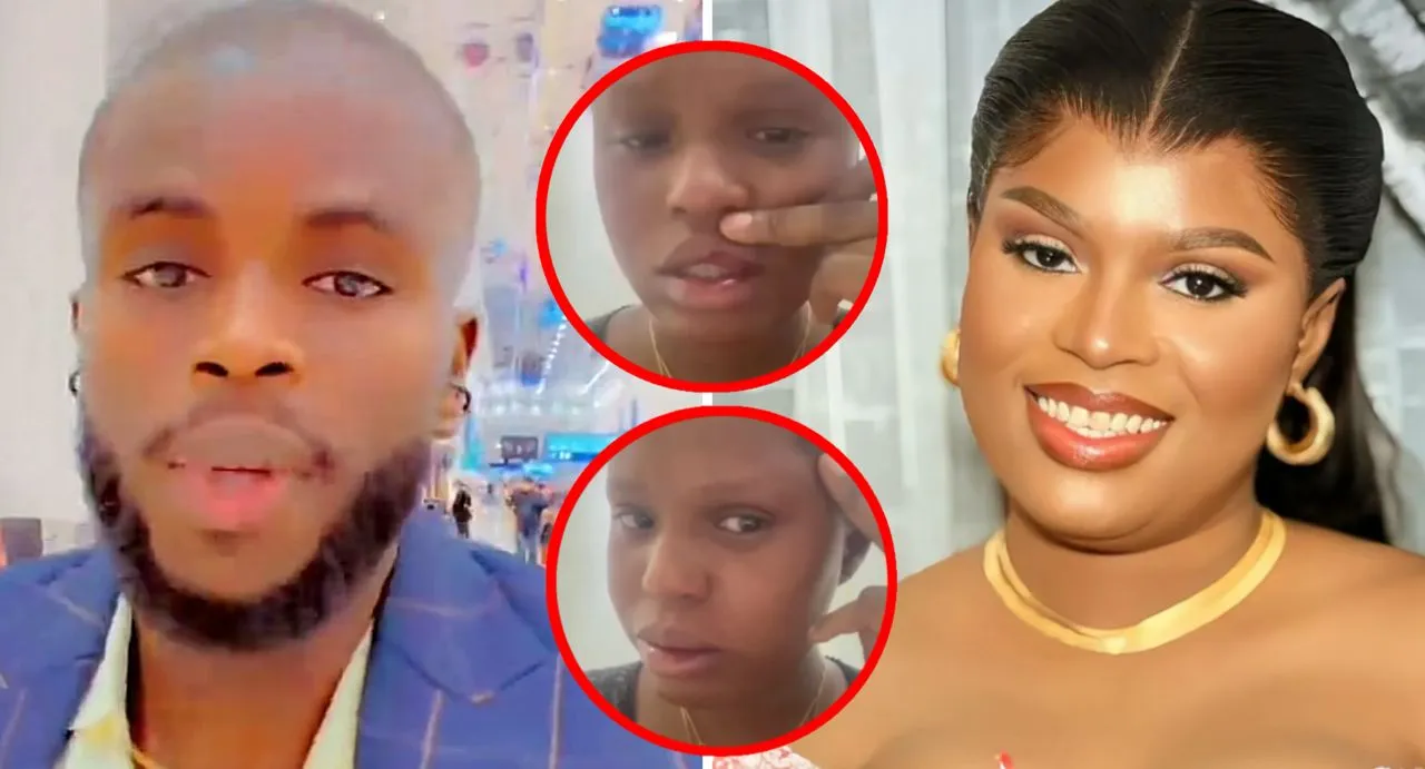 Sénégal – Violences conjugales : La première épouse de Sohibou Telecom l’accuse de l’avoir « défigurée » (Vidéo)