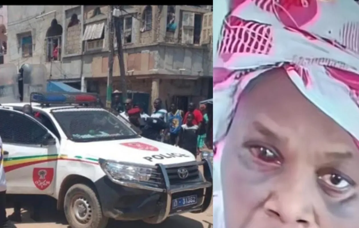 Keur Massar : Mariama Ba succombe à ses blessures après une altercation avec son époux