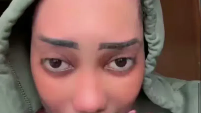 Erreur médicale présumée : Alima Suppo raconte les circonstances de l&rsquo;amputation du doigt de son fils (Vidéo)