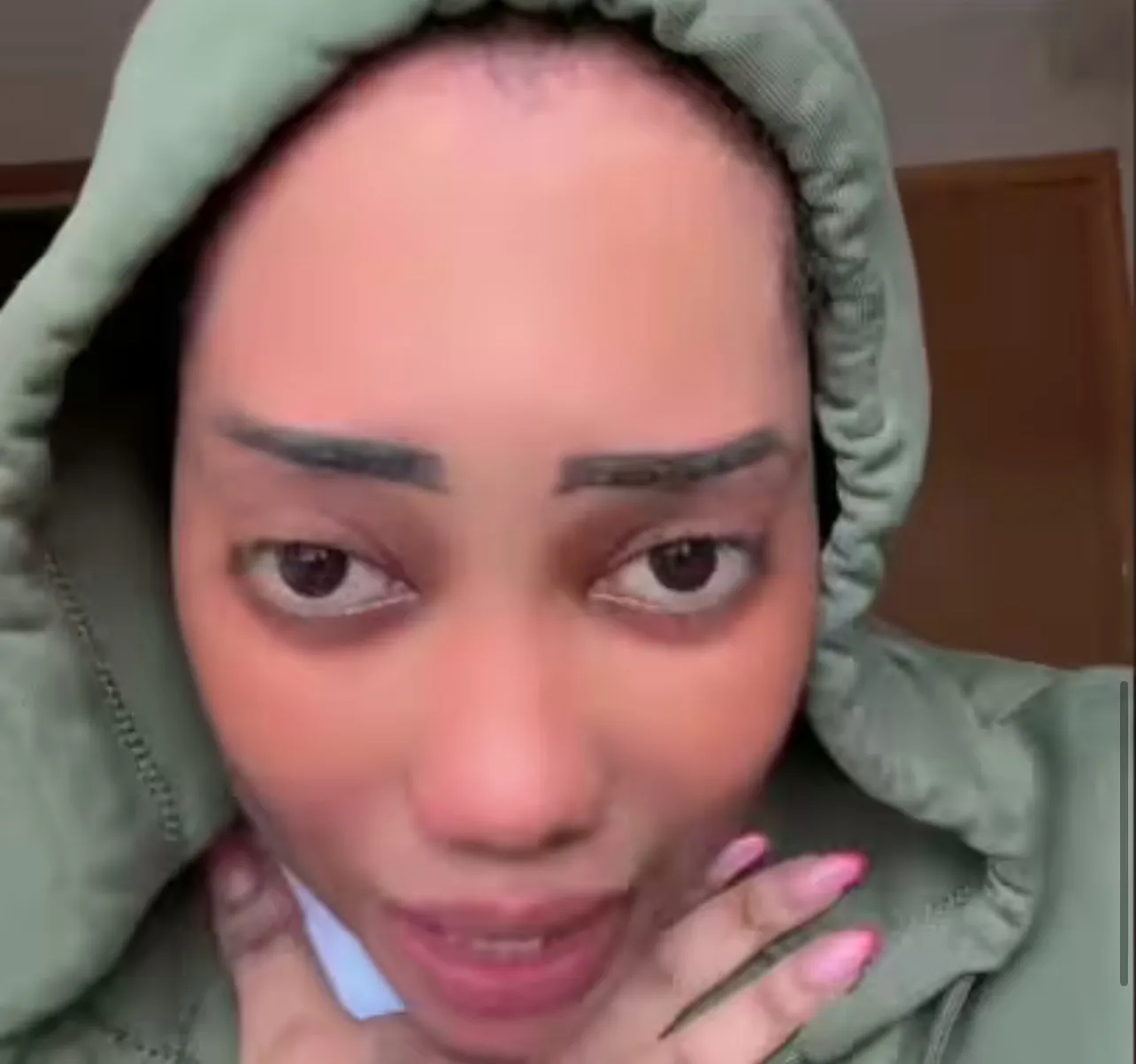 Erreur médicale présumée : Alima Suppo raconte les circonstances de l’amputation du doigt de son fils (Vidéo)