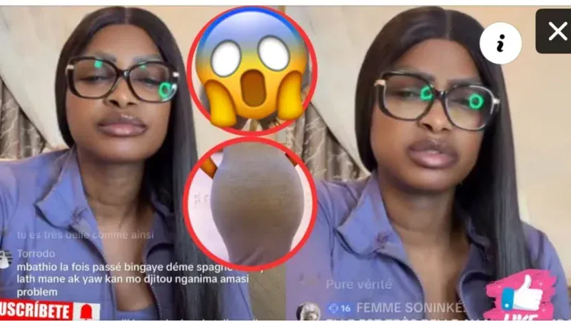 Chirurgie esthétique : Les révélations de Mbathio Ndiaye sur les graves séquelles de certaines interventions (Vidéo)