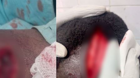 Violente dispute à Touba : un enseignant coranique attaqué à la machette…