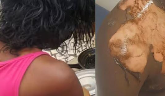 Altercation autour d’une bouilloire à Richard-Toll : K. Aw ébouillantée par sa belle-sœur…