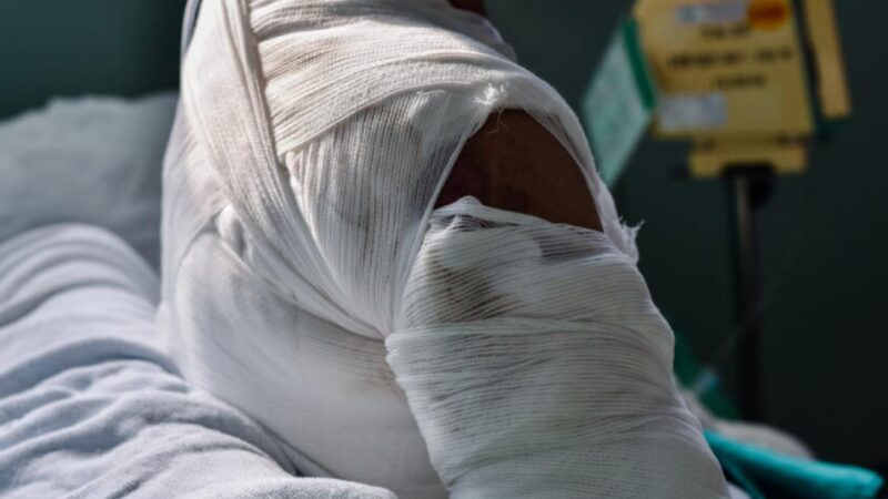 Richard-Toll : une femme ébouillante sa rivale, 21 jours d’incapacité temporaire de travail