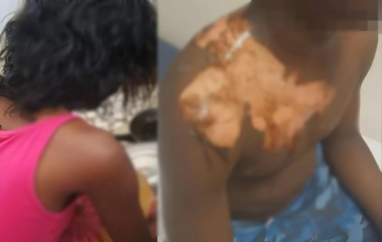 Ross-Béthio : une femme verse de l’eau bouillante sur son mari et sa coépouse