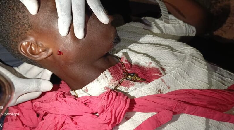 Sédhiou : Un jeune étudiant blessé à la mâchoire lors du vol de sa motocyclette