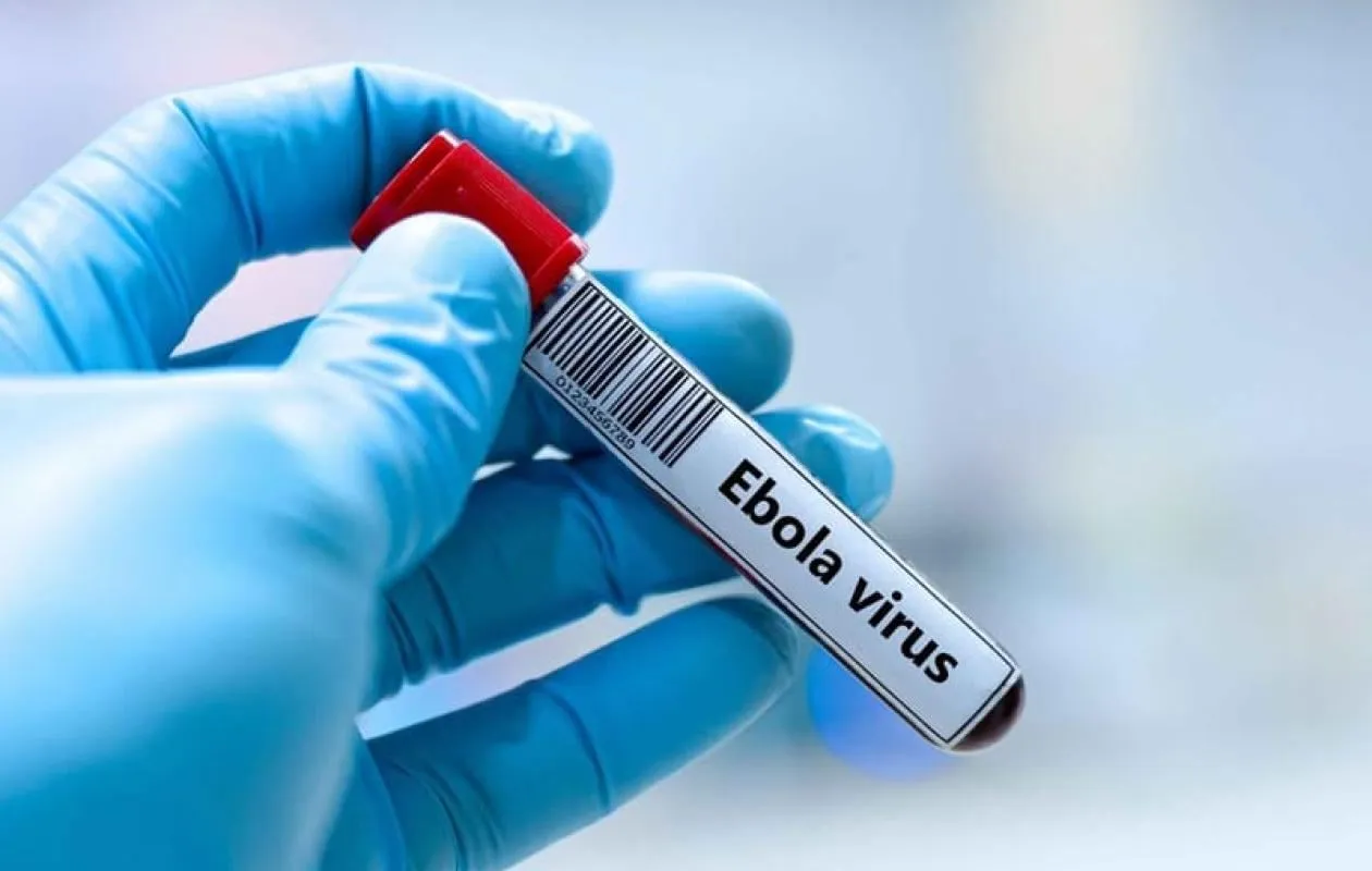 Ebola : un médecin humanitaire testé positif à Paris après un vol depuis la RDC, son état est stable